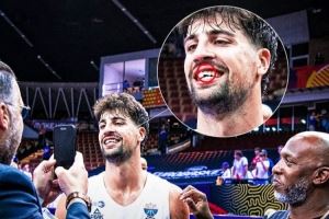 磕掉半颗大门牙！阿夫迪亚率队拿首胜：一切都值得！